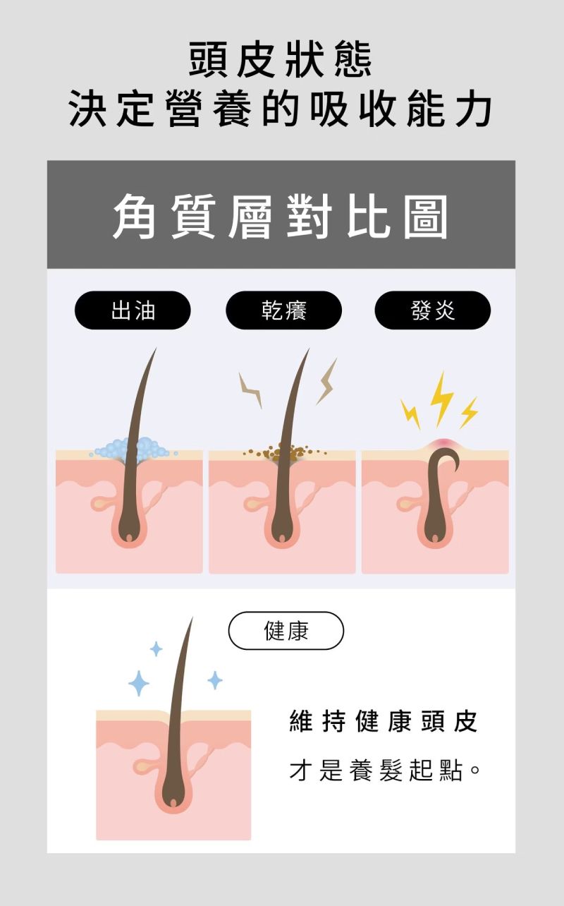 諾亞外泌體初源養髮液,維護健康頭皮環境,改善出油、乾癢與發炎困擾